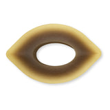 Hollister Adapt CeraRing Two-Piece Skin Barrier, Flat - 89530-Box - LL Medico
