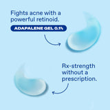 Differin Adapalene Gel 0.1% Acne Treatment