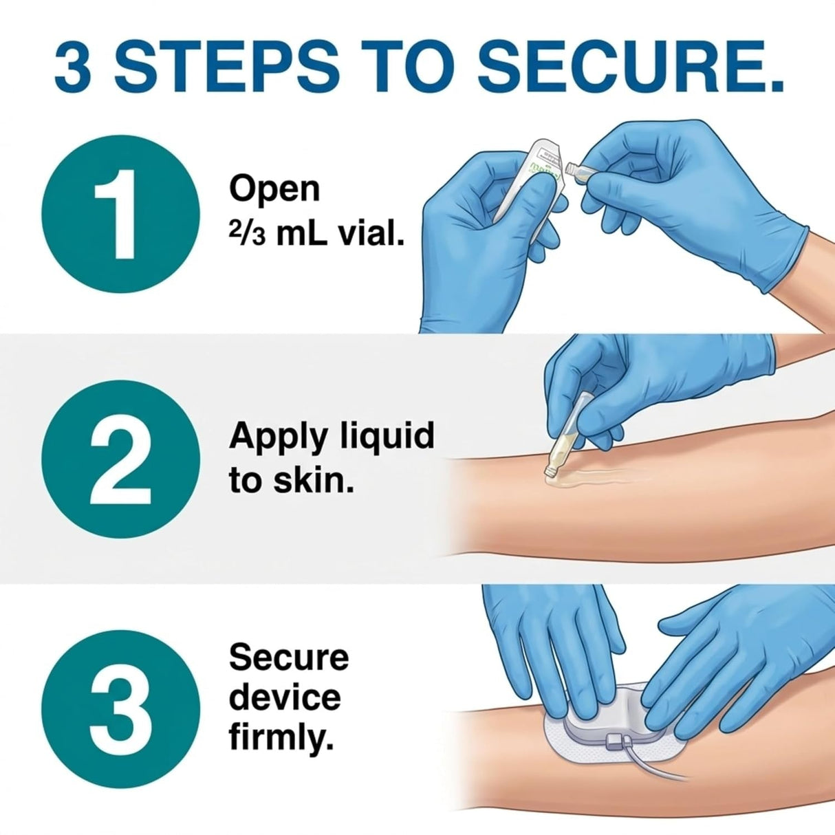 Mastisol Liquid Adhesive, Latex-Free, 2/3 mL Vials - 00496052306-Single - LL Medico