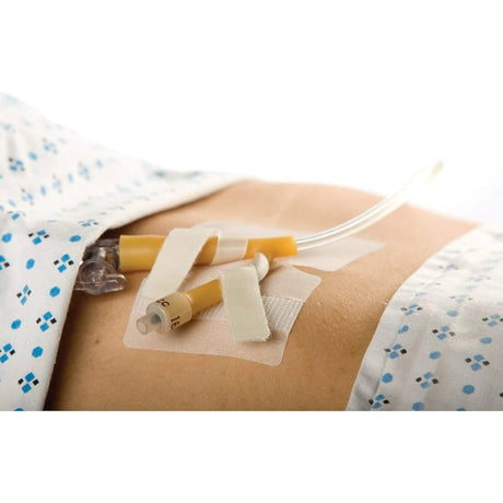 M.C. Cath-Secure Dual Tab Catheter Holder - 5445-4-Single - LL Medico