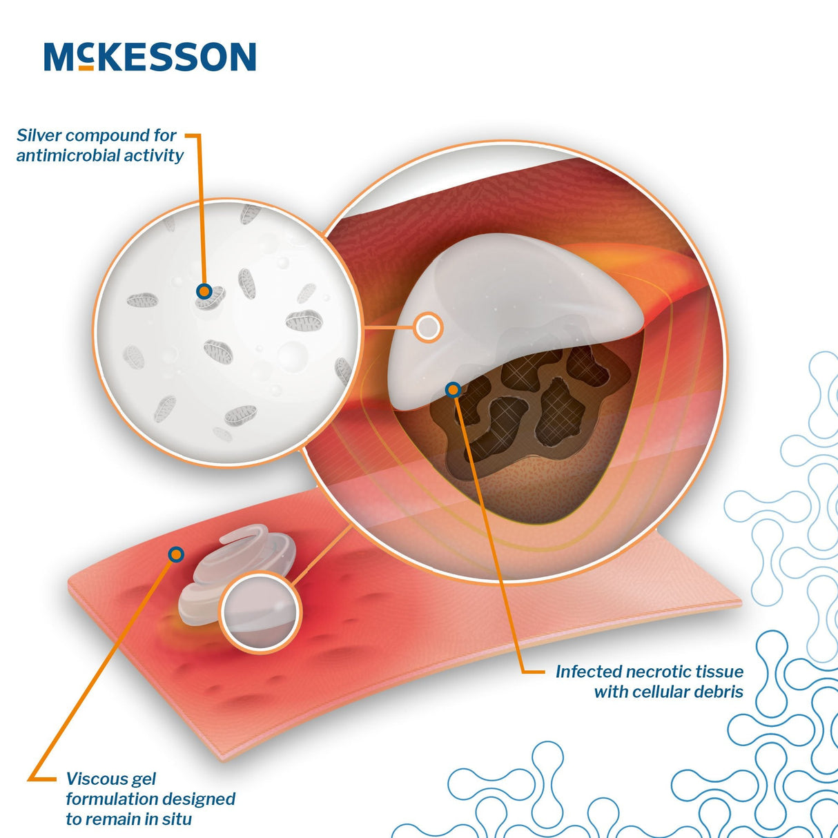 McKesson Silver Antibacterial Wound Gel - 1726-Single - LL Medico