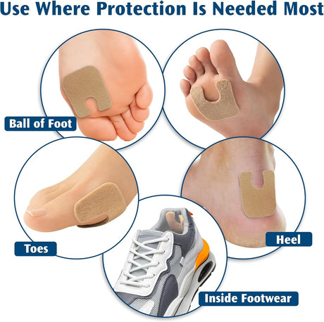 PediFix FELTastic Callus Protectors, Self-Adhesive, 8 Pieces - 8023-40-Pack - LL Medico
