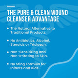 Pure&Clean Wound Cleanser, Non-Sterile, 8 fl oz Spray Bottle - 852421007027-Single - LL Medico